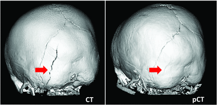 FIG 3.