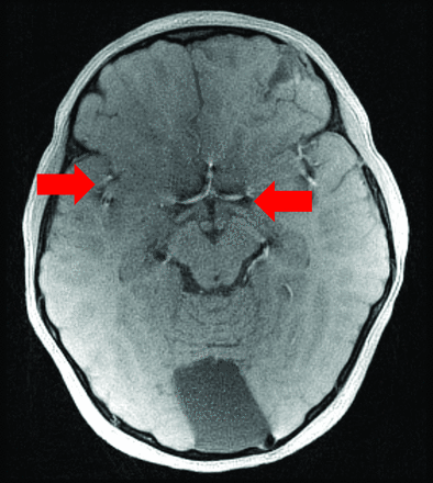 FIG 4.