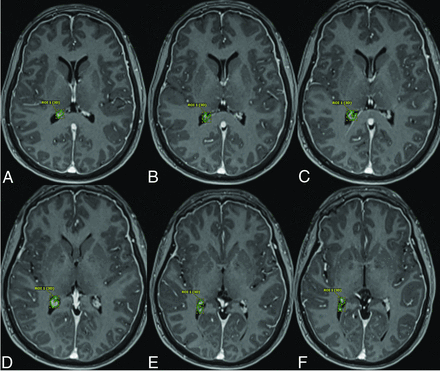 FIG 1.