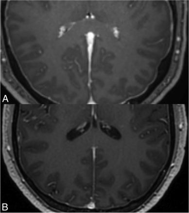 FIG 2.