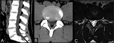 FIG 1.