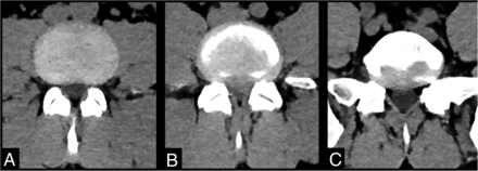 FIG 3.