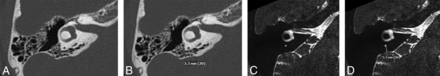 FIG 2.