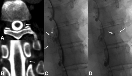 FIG 2.