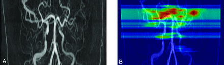 FIG 1.