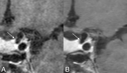 FIG 2.