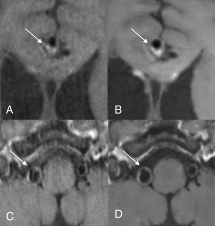 FIG 3.