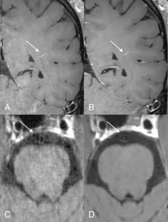 FIG 5.