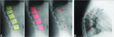 FIG 3.