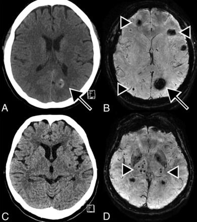 FIG 4.