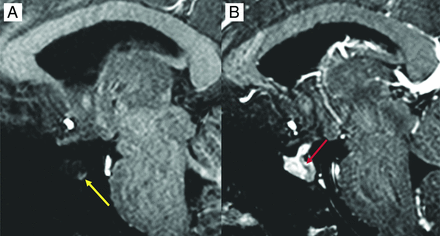 FIG 1.