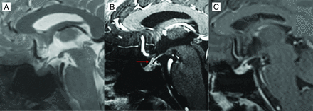 FIG 3.