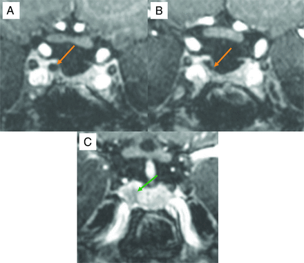FIG 5.