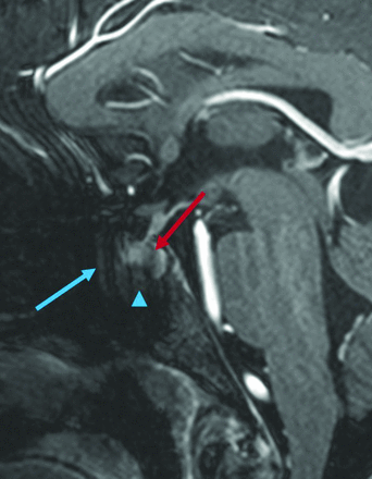FIG 6.