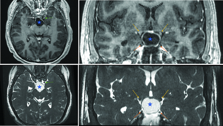FIG 1.