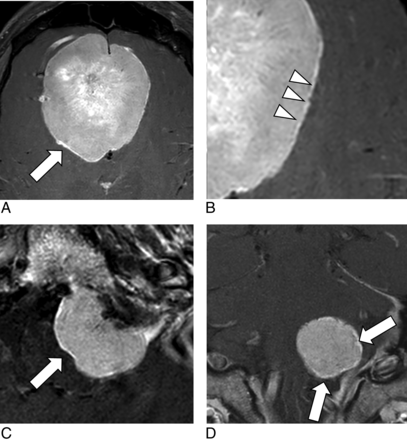 FIG 2.