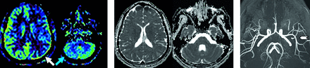 FIG 4.