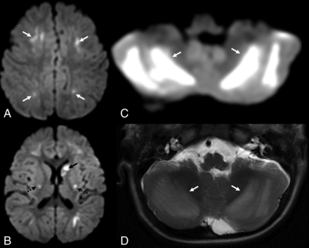FIG 2.