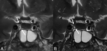 FIG 1.