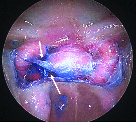 FIG 3.