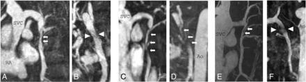 FIG 1.