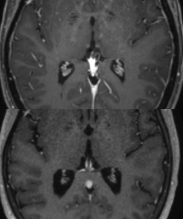 FIG 2.