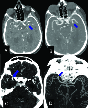 FIG 4.