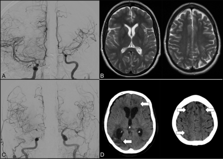 FIG 1.