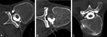 FIG 5.