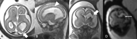 FIG 1.