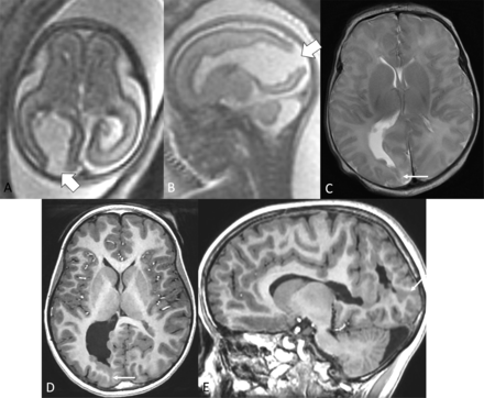 FIG 3.