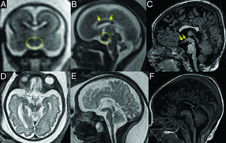 FIG 2.