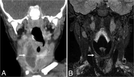 FIG 6.