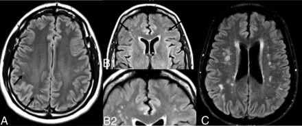 FIG 1.