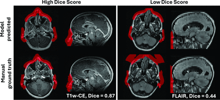FIG 3.