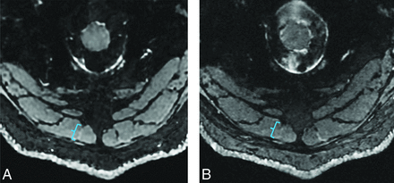 FIG 2.