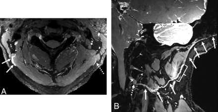 FIG 5.