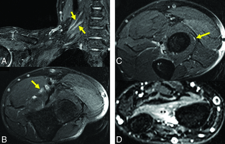 FIG 2.