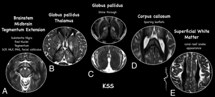 FIG 5.