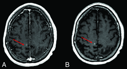 FIG 4.