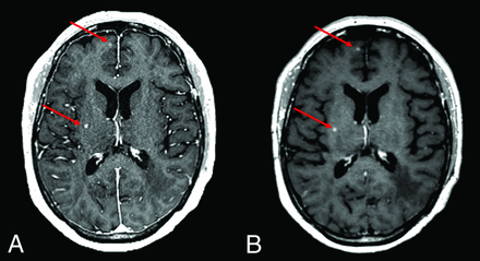 FIG 5.