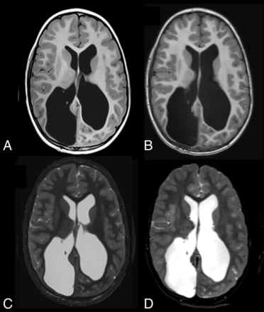 FIG 4.
