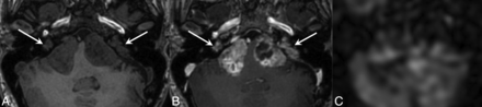 FIG 2.