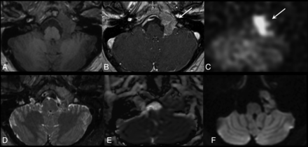 FIG 3.