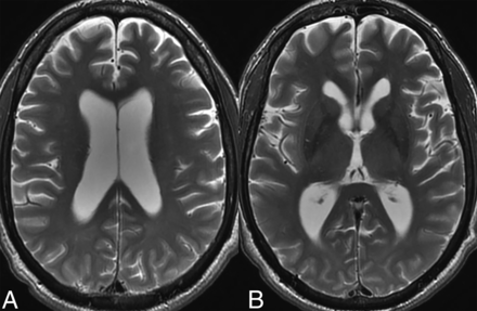 FIG 1.