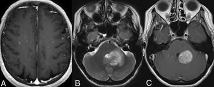 FIG 2.