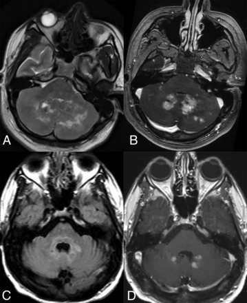 FIG 3.