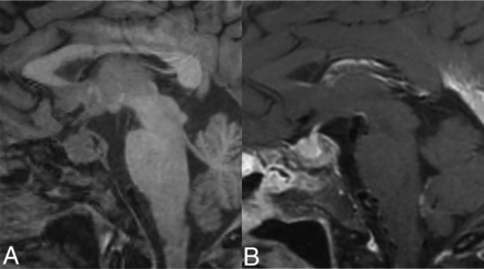 FIG 6.