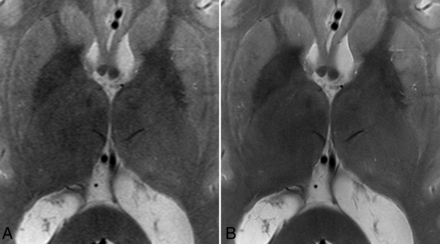 FIG 2.