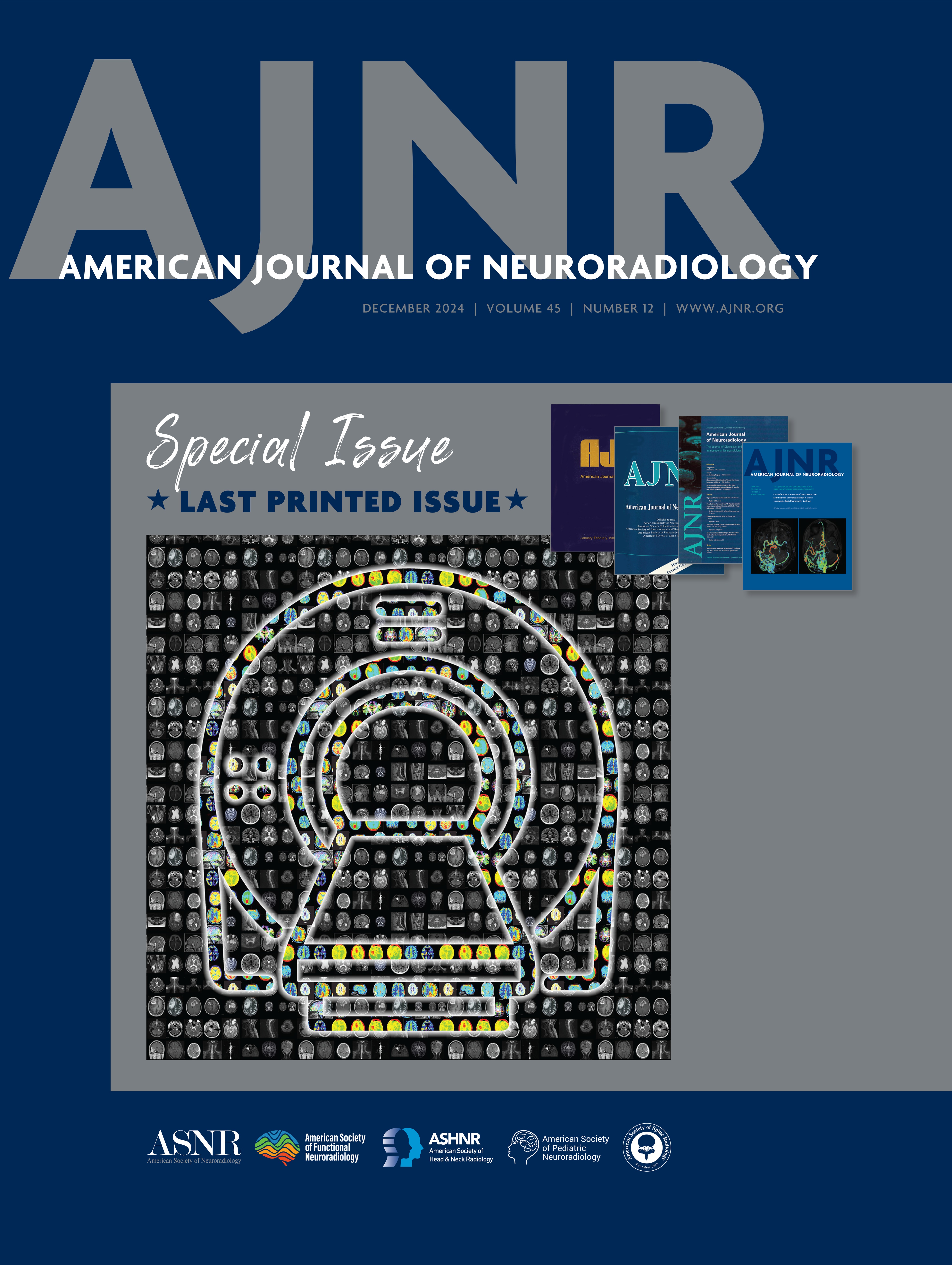 American Journal Of Neuroradiology